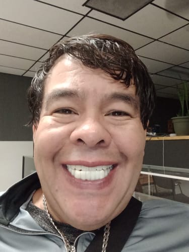 Customer photo review of Pop On Veneers with Impression Kit