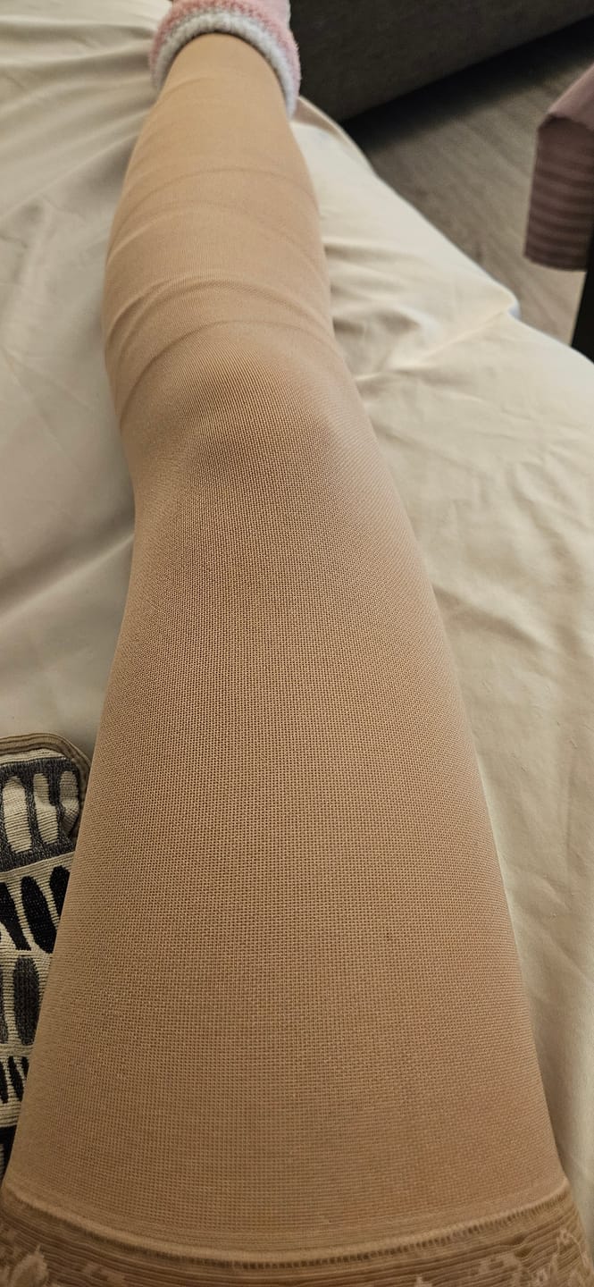 Customer photo review of Sigvaris Soft Opaque Open Toe Thigh High