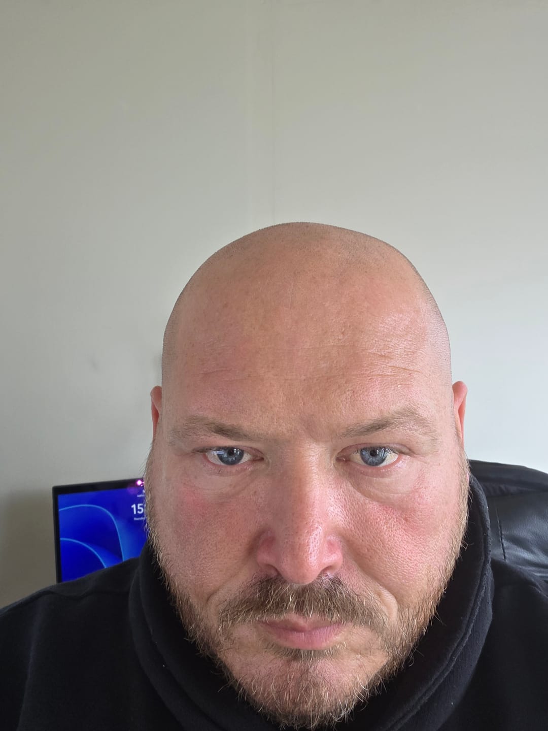 Customer photo review of Trimpod 3.0: The Ultimate Shaver for Bald Men
