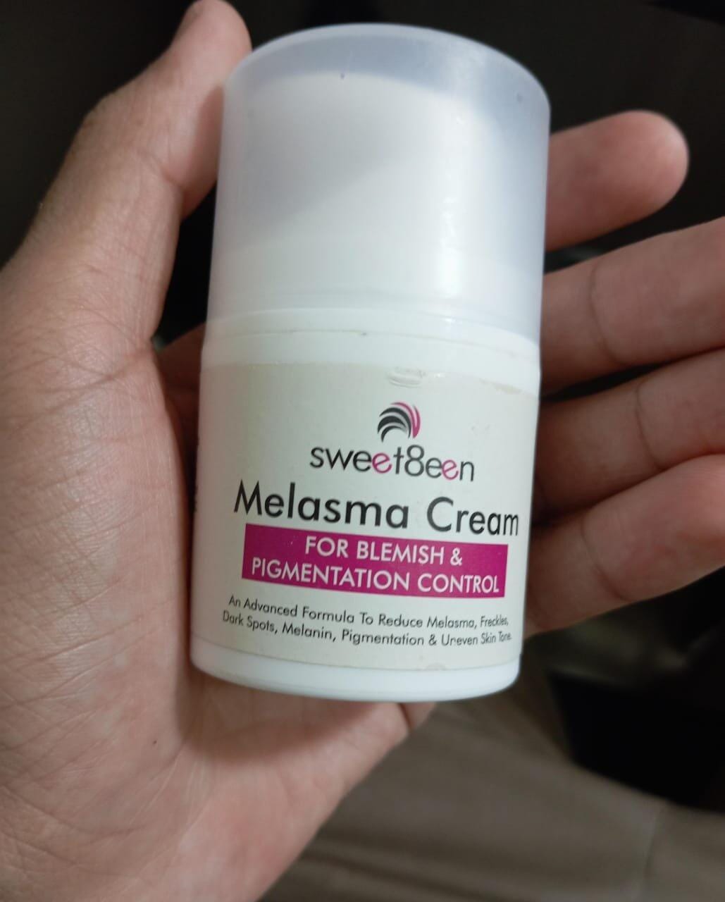 Customer photo review of Melasma Cream