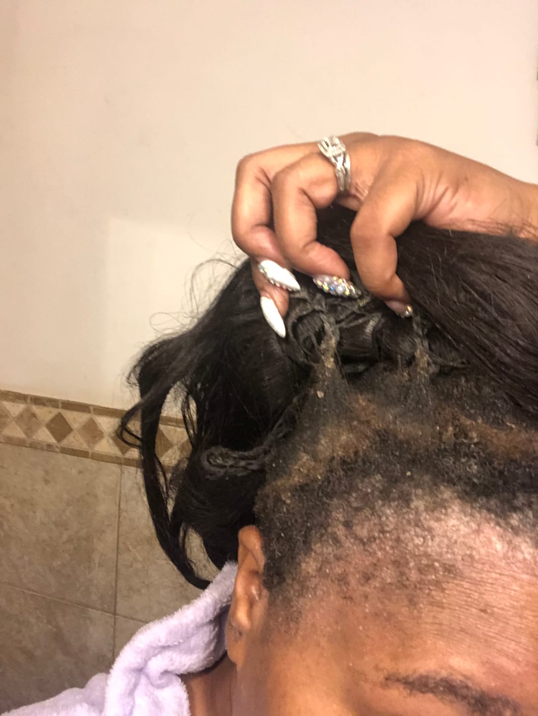 Customer photo review of Avocado Oil Stimulating Hair Growth Serum