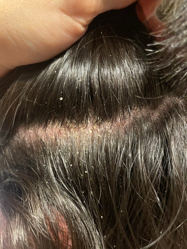 Customer photo review of Seb Natural Calming Serum