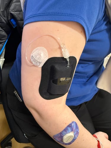 Customer photo review of Skin Grip - Tandem Mobi Pocket Patch