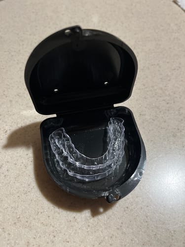 Customer photo review of Extra Impression Putty (STRONGLY RECOMMENDED)
