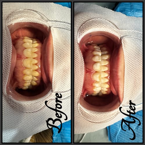 Customer photo review of Teeth Whitening Online Course