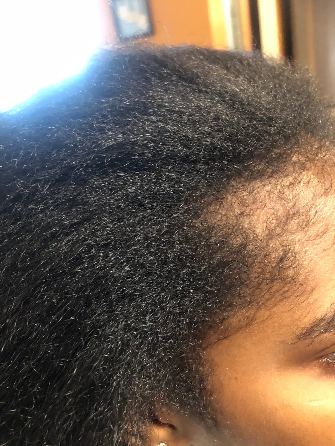 Customer photo review of Avocado Oil Stimulating Hair Growth Serum