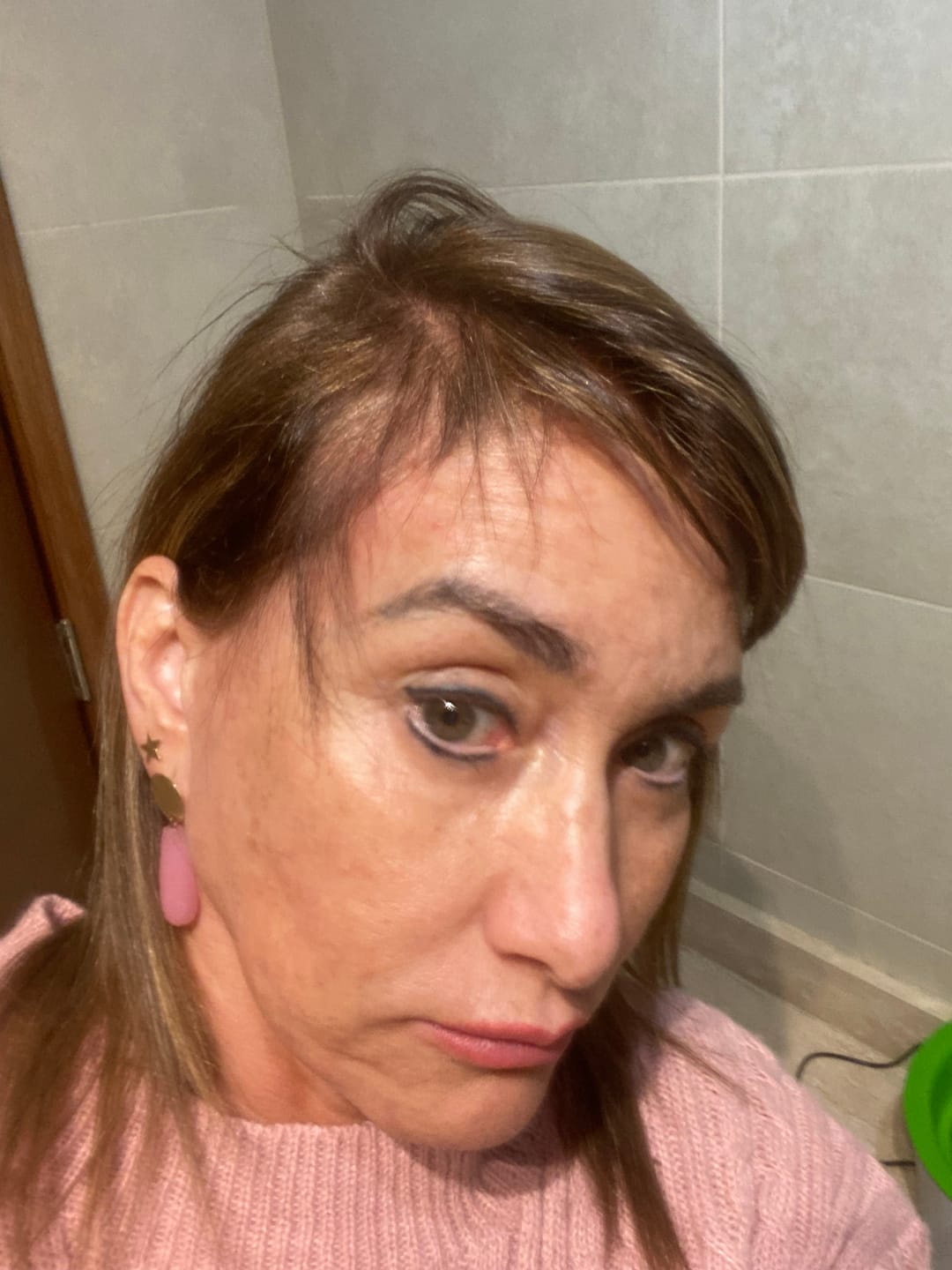 Customer photo review of Tónico Anticaída