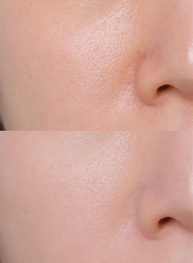 Customer photo review of NiaRonic Serum (Pore Minimizing)