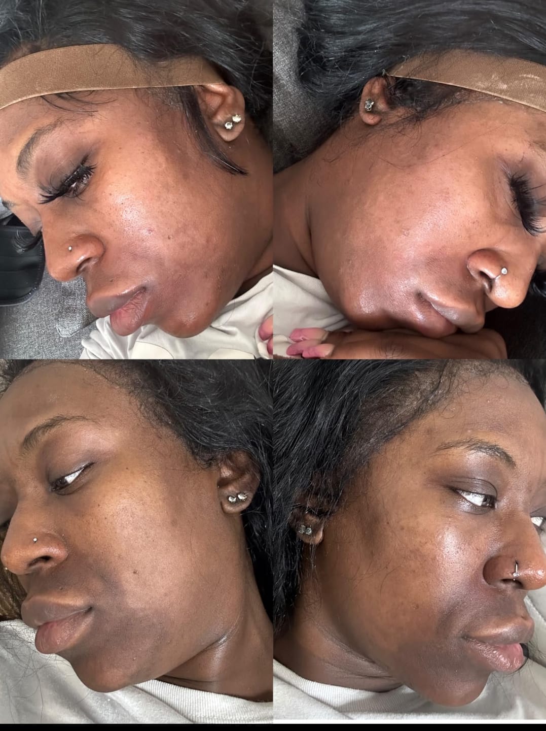 Customer photo review of Radiant Brightening Face Cream
