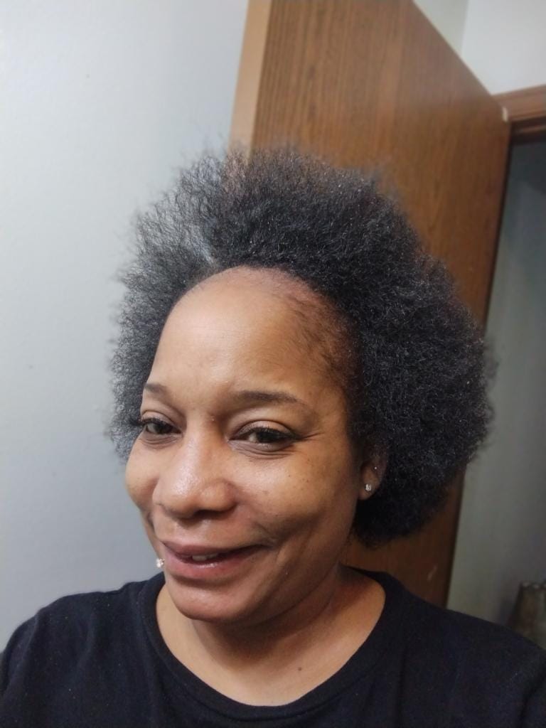 Customer photo review of Avocado Oil Stimulating Hair Growth Serum