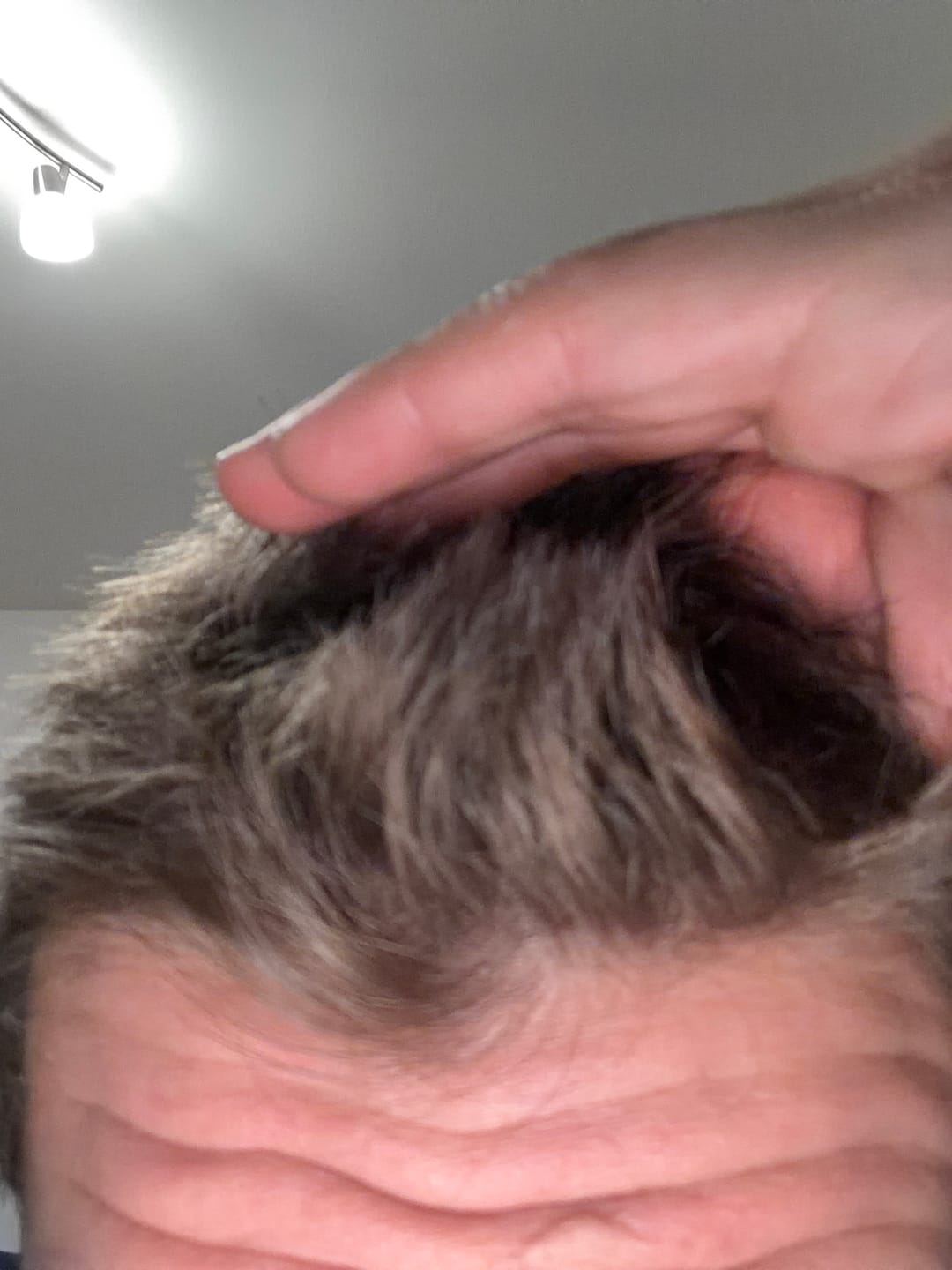 Customer photo review of Lion's Mane™