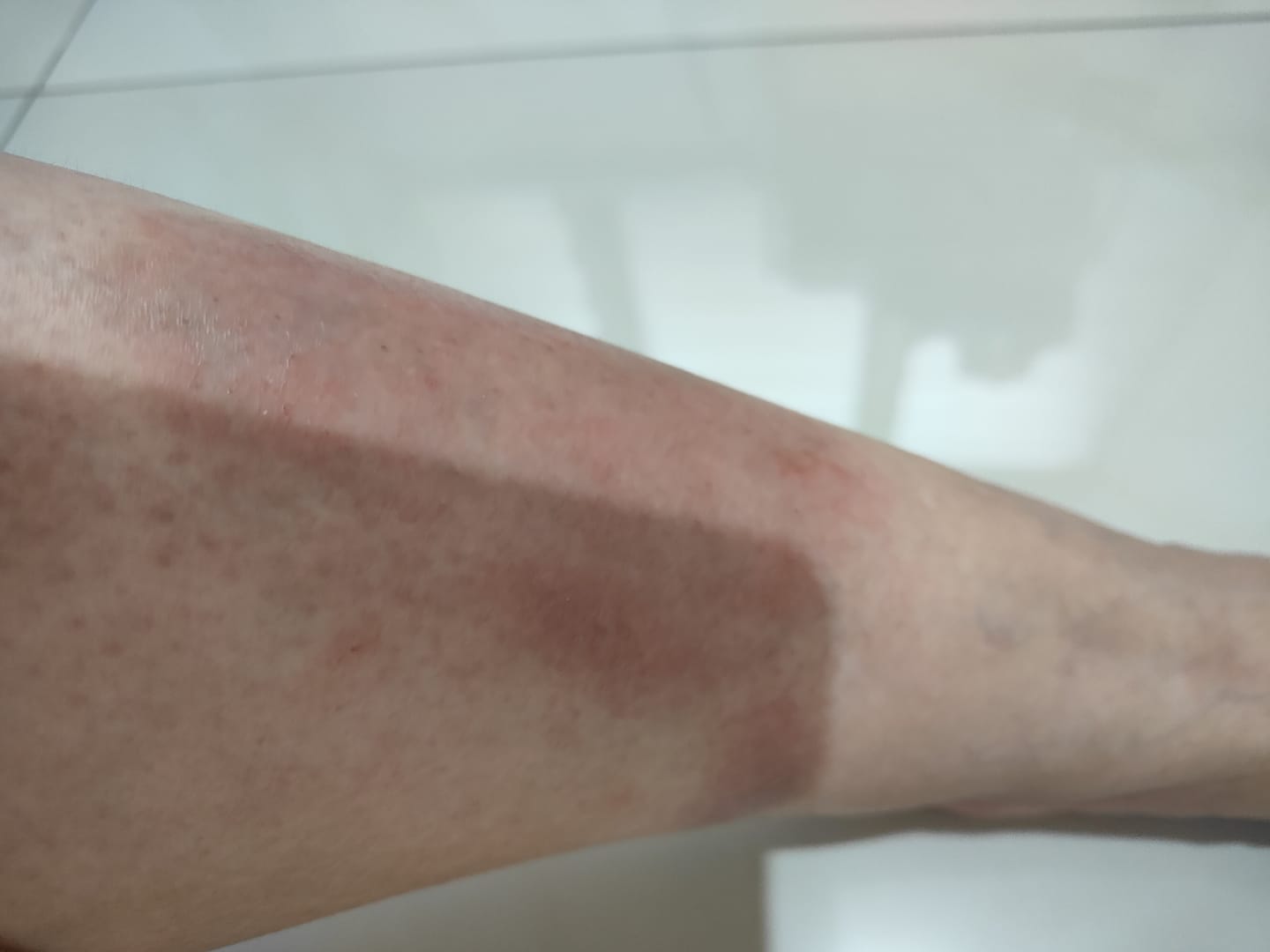 Customer photo review of RCV PRO – The Revolutionary Skin Supplement