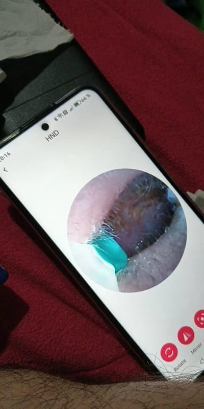 Customer photo review of EarVision Pro™