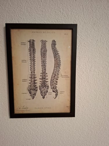 Customer photo review of Spine | Structure and Anatomy