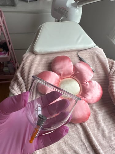 Customer photo review of Premium Cupping Cups - Mixed Sizes from B1 to B6
