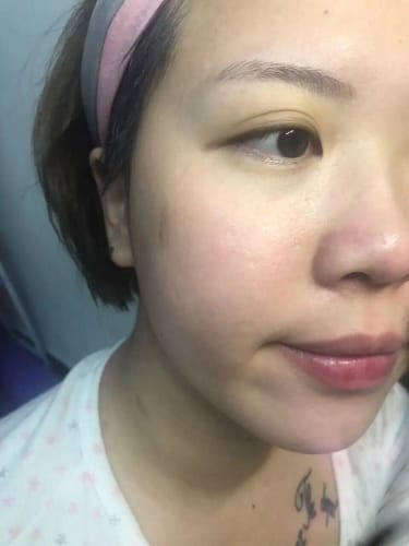 Customer photo review of LUMORA™ Copper Peptide Serum