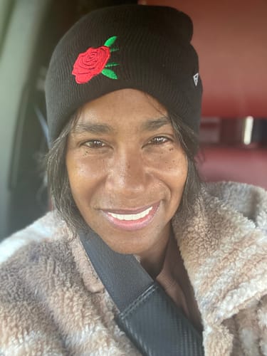 Customer photo review of Pop On Veneers - Custom Made Production