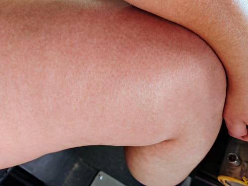 Customer photo review of Bumbum Cream 200g