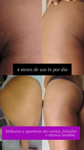 Customer photo review of Bumbum Cream 200g