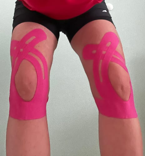 Kundenbewertung mit Foto zu TAPEX™ - Kniegelenk