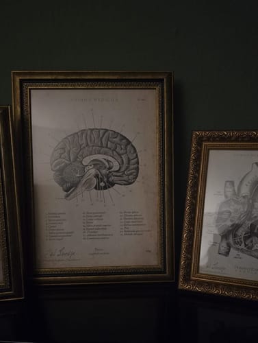 Customer photo review of Brain in Sagittal Section