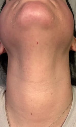 Customer photo review of SuaviPro™