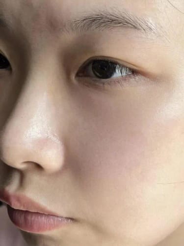 Customer photo review of LUMORA™ Copper Peptide Serum