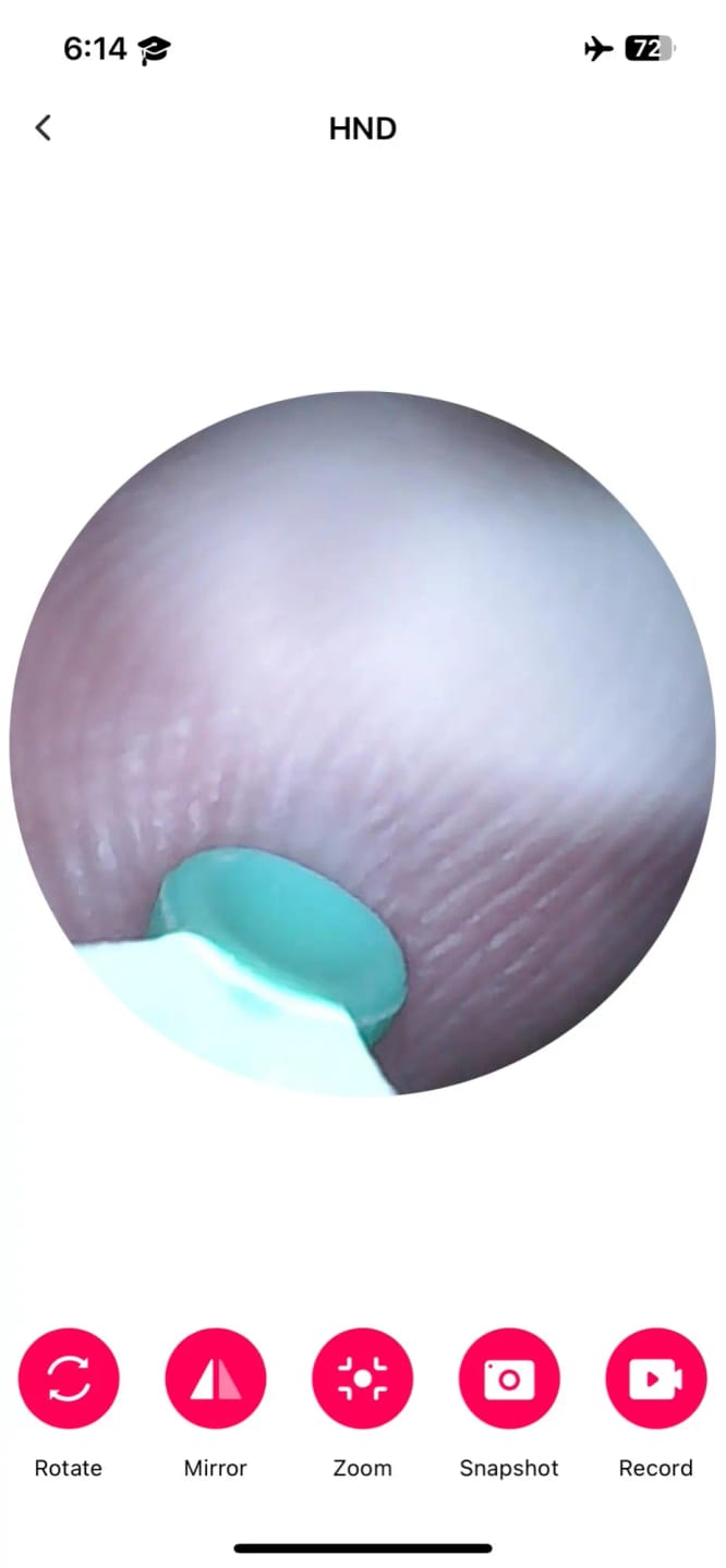 Customer photo review of EarVision Pro™