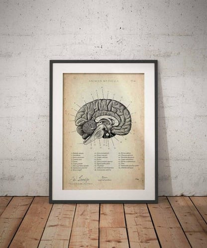 Customer photo review of Brain in Sagittal Section