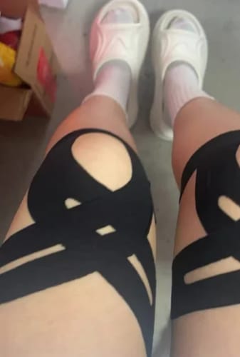 Kundenbewertung mit Foto zu TAPEX™ - Kniegelenk