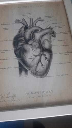 Customer photo review of Heart Anatomy