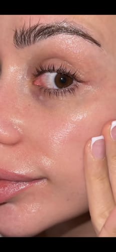 Customer photo review of LUMORA™ Copper Peptide Serum