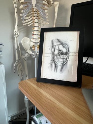 Customer photo review of Unhappy Triad Knee