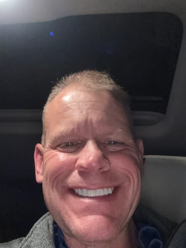 Customer photo review of FIRST REMAKE Pop On Veneers