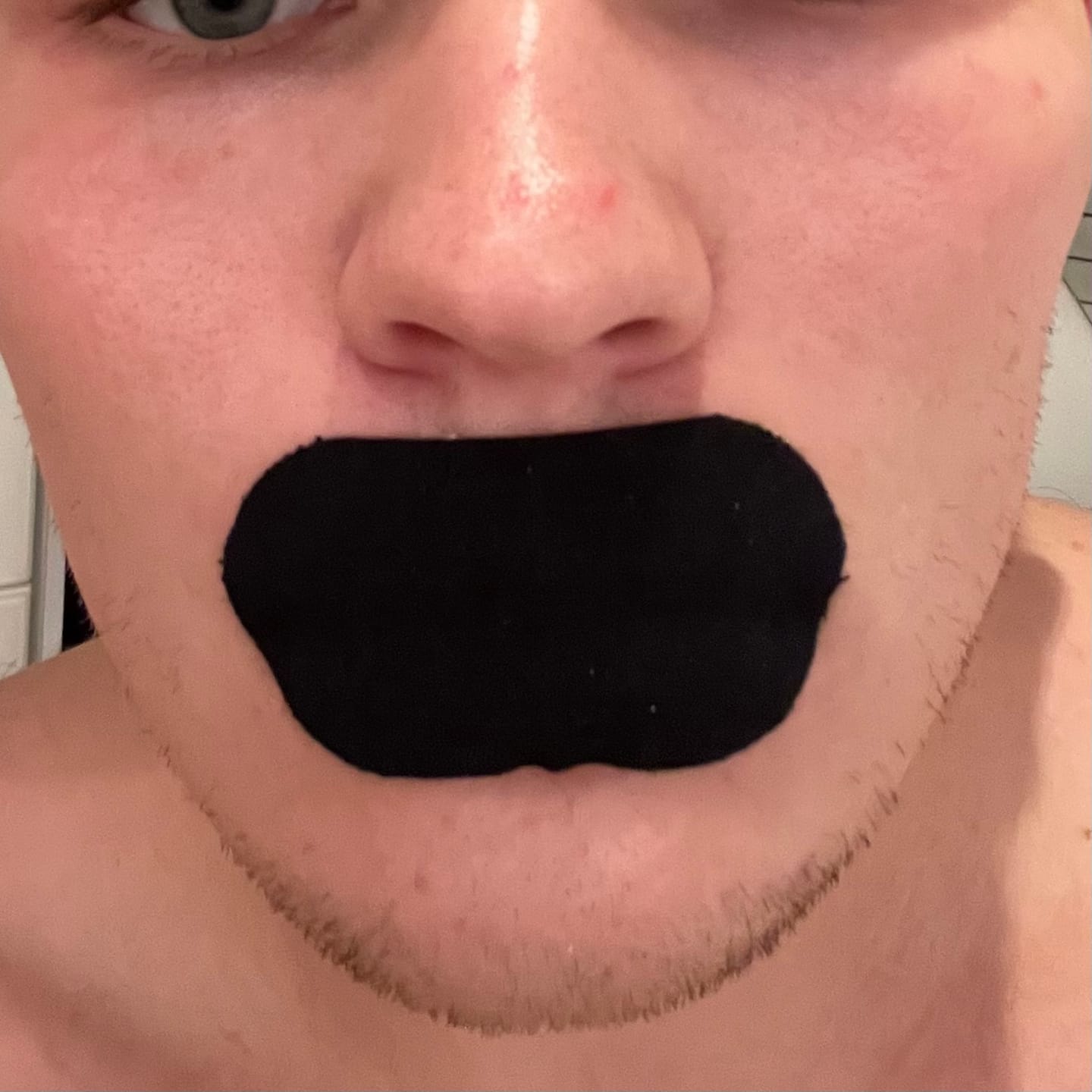 Customer photo review of Mouth Tape