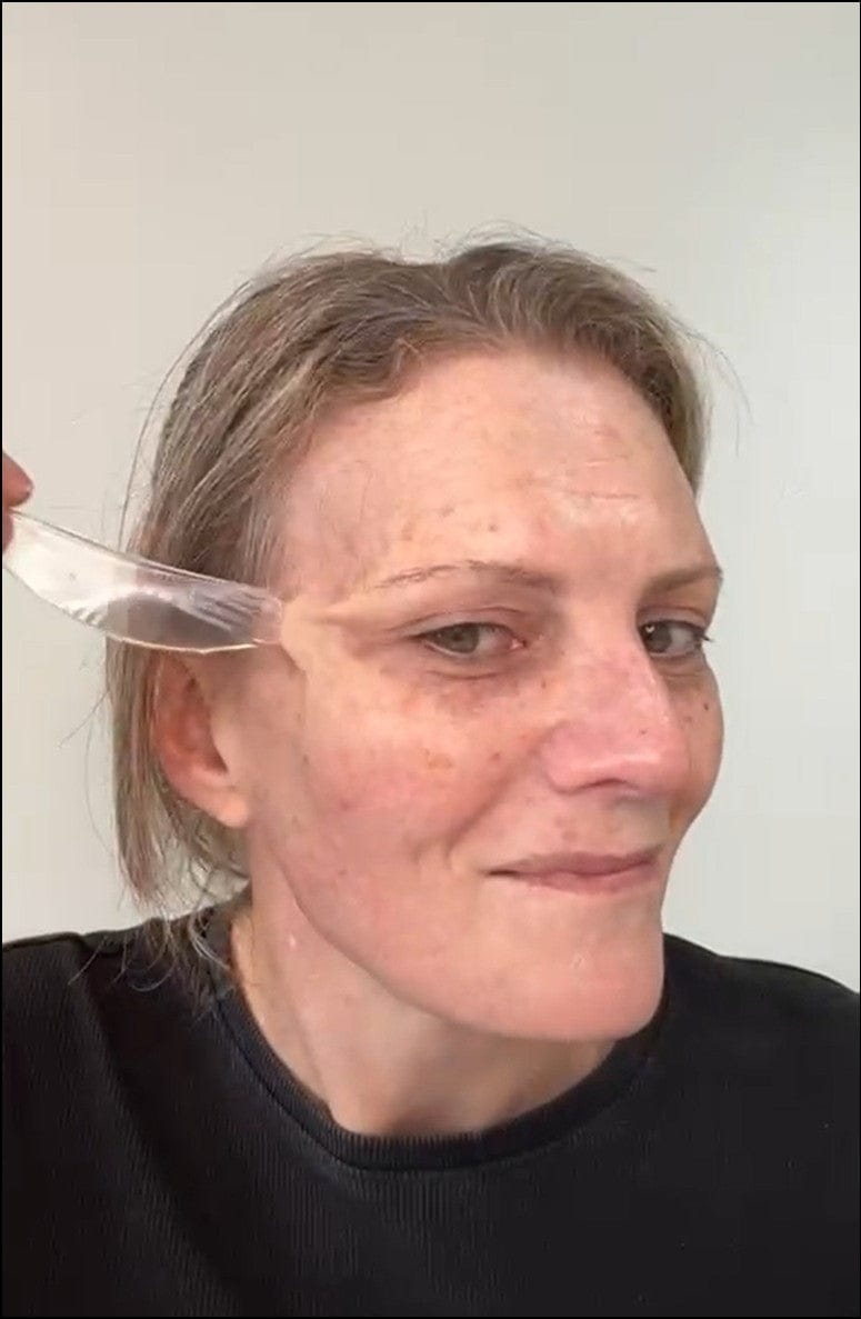 Customer photo review of Full Face Silicone Patch Kit
