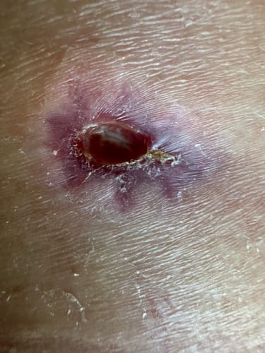 Customer photo review of Tepezcohuite Bark