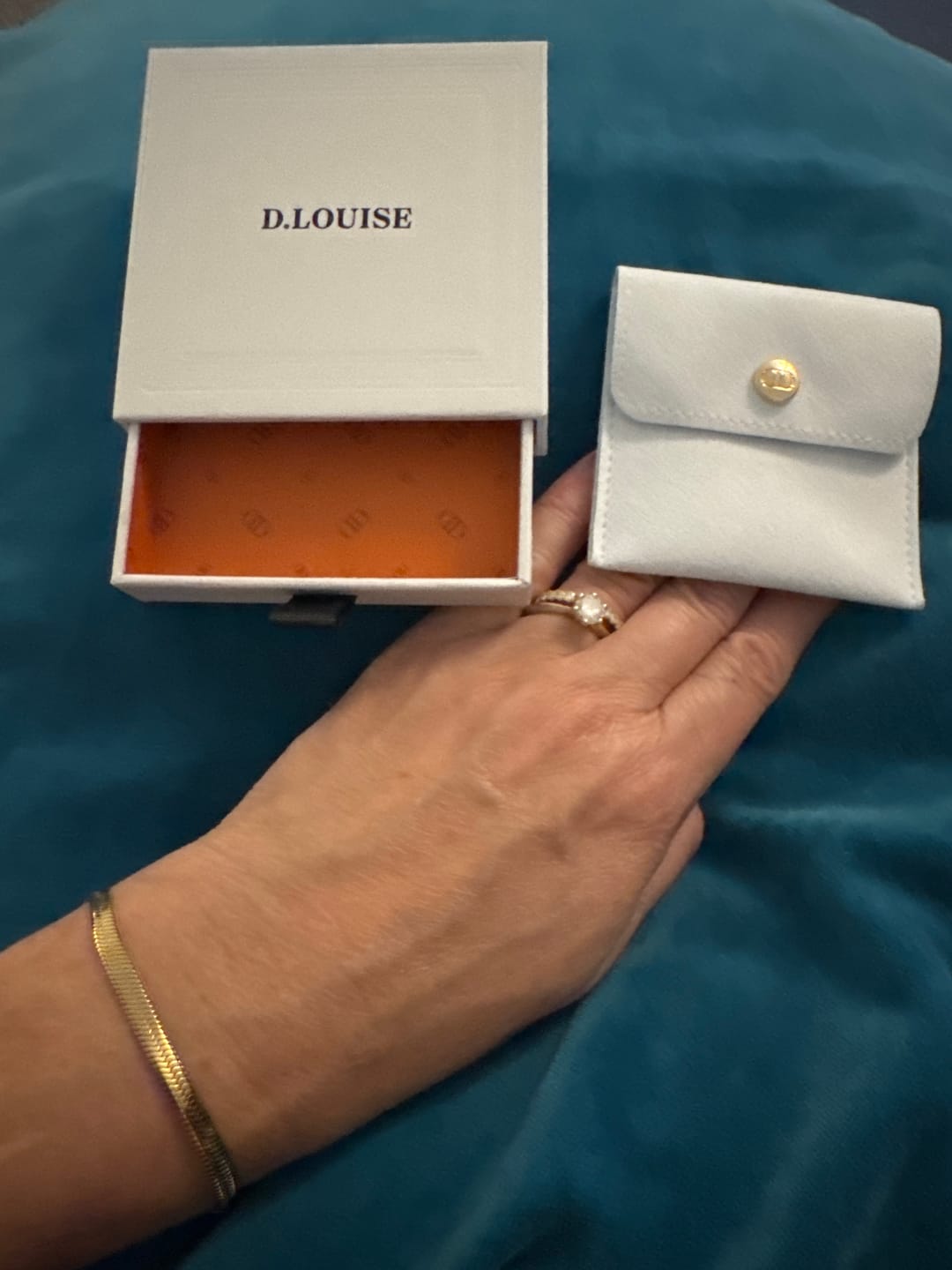 Customer photo review of Essentials Bracelet