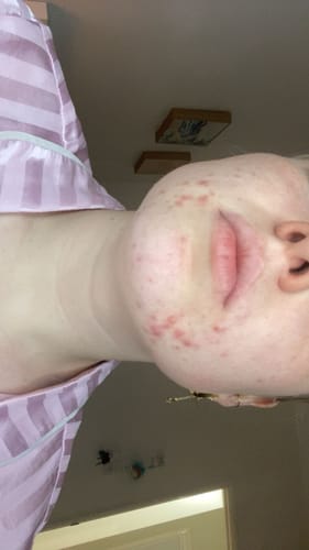 Customer photo review of 20-Day Inside & Out™