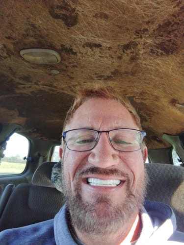 Customer photo review of FIRST REMAKE Pop On Veneers