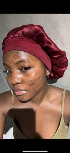 Customer photo review of Orlia skincare