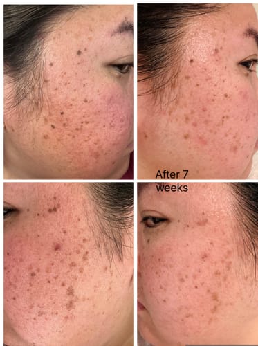 Customer photo review of BEAUTY GLOW DUO - SUPER STICK + MOISTURISER