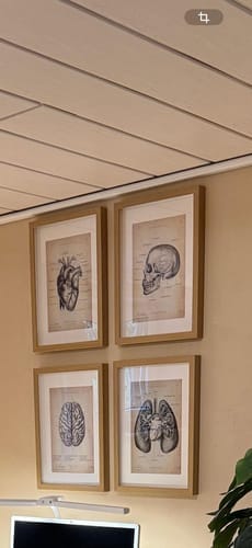 Customer photo review of Skull Anatomy