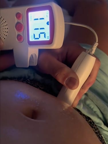 Customer photo review of BabyEcho Doppler™