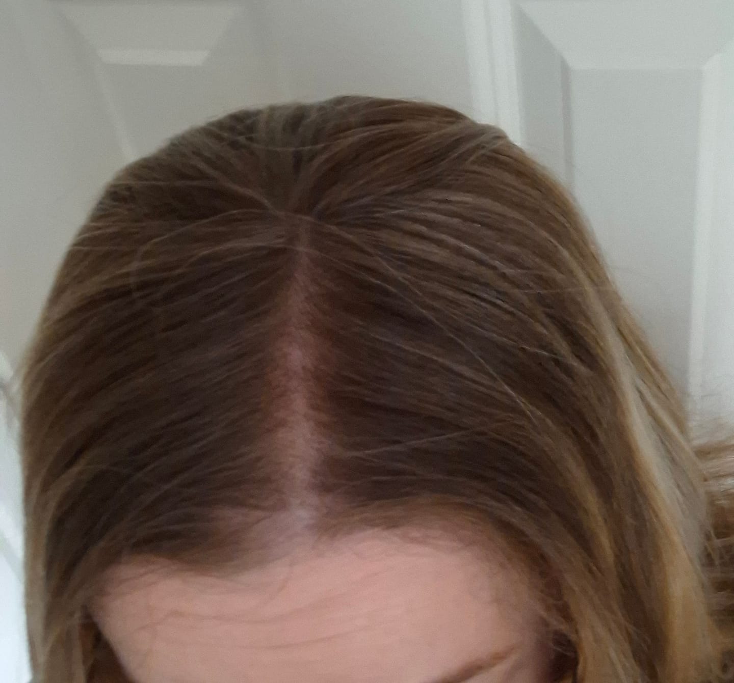 Customer photo review of Volume Plus Lace Topper