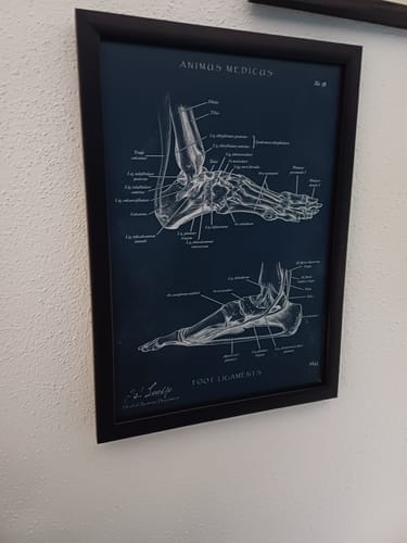 Customer photo review of Foot straps - Chalkboard