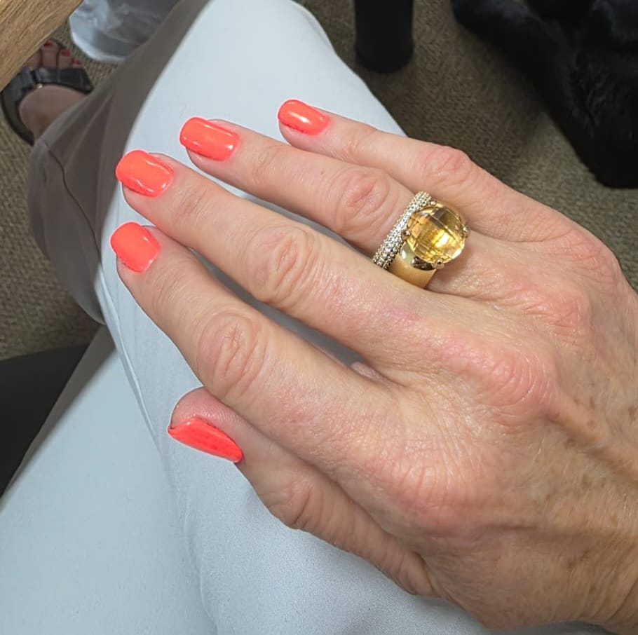 Customer photo review of Seano Top 13mm in Gold