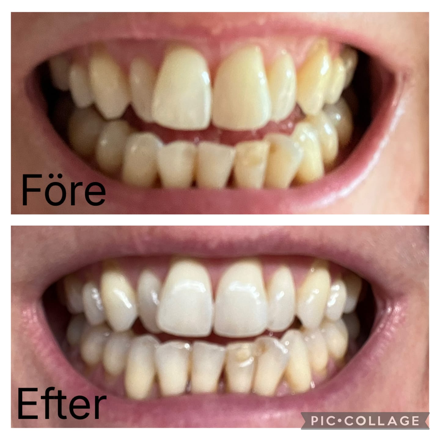 Customer photo review of Loiste eltandborste