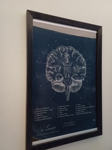 Customer photo review of Gehirn Aufbau im Schnitt - Chalkboard