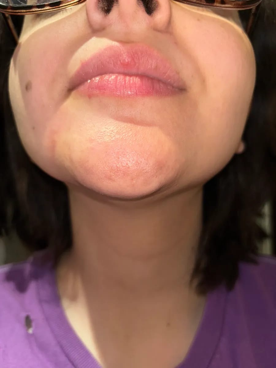 Customer photo review of SkinUp Pro